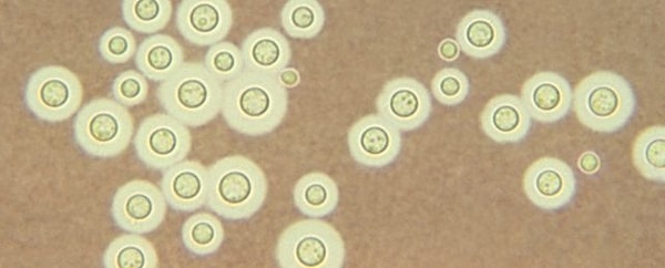 Kritik kategoriye dahil edilen "cryptococcus neoformans" olarak bilinen mantar büyük bir tehdit olarak listelendi.