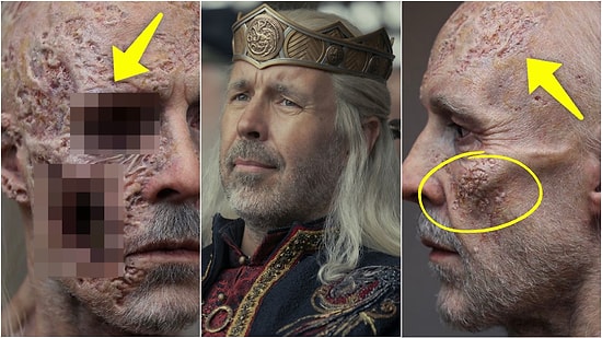 House of the Dragon’da Kral Viserys’a Hayat Veren Paddy Considine’ın Adeta Sanat Eseri Olan Protez Makyajı