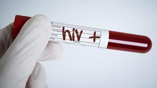 Mutlaka duymuşsunuzdur ama bilmeyenler için biraz bahsedelim. HIV yani 'İnsan Bağışıklık Yetmezliği Virüsü' tedavisi sağlanmadığı zaman bağışıklık sistemini zayıflatarak AIDS’e neden olan bir virüs.