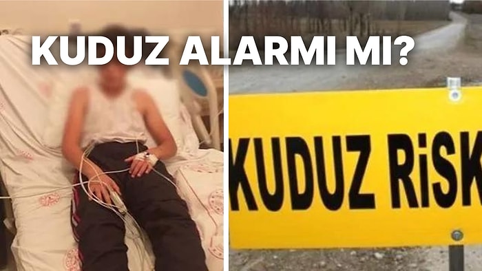 Bir Çocuğa Kuduz Teşhisi Konmuştu! Yüzde Yüz Öldürücü Olduğu Söylenen Kuduzla İlgili Bilmeniz Gerekenler