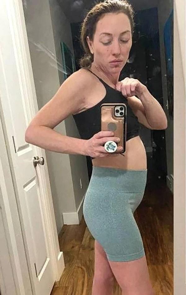 2014 yılında öz güvensiz hissettiği için bıçak altına yatmaya karar veren Sara Gowen, meme implantı yaptırdı.