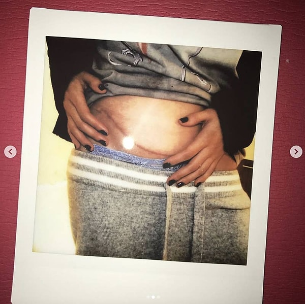 “Нет слов, чтобы описать, как я могу отблагодарить мою прекрасную подругу Франшу Рейзу”, - написала тогда Селена. “Она сделала мне величайший подарок и пожертвовала собой, пожертвовав мне свою почку. Я невероятно благословлена. Я так сильно люблю тебя, сестренка.”