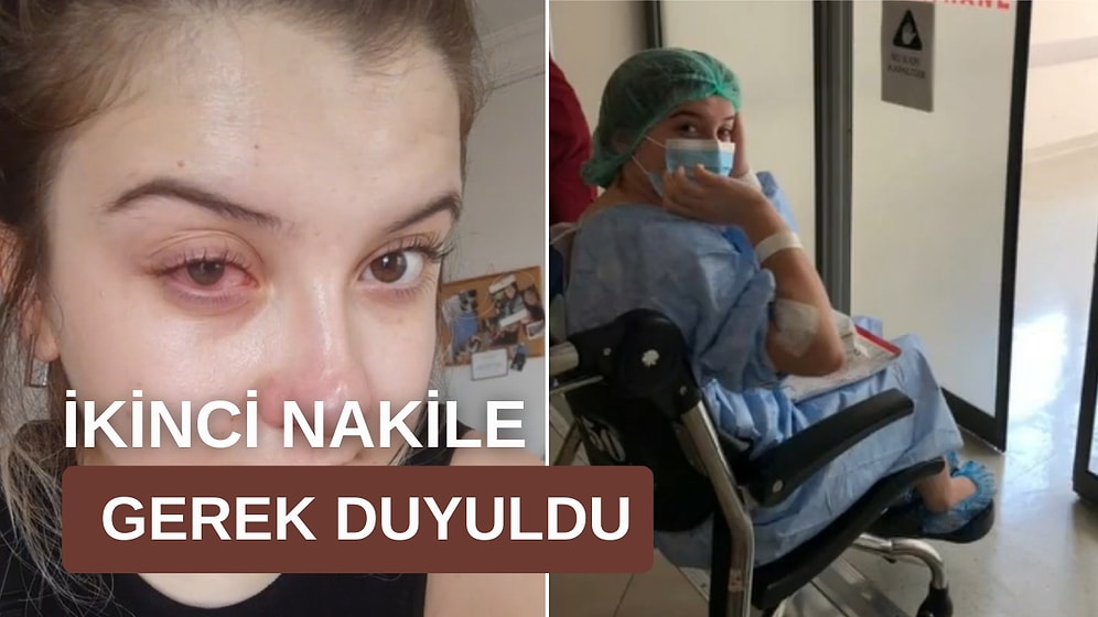 Yeni Fobimiz Hayırlı Olsun: Lensle Uyuduğu için Gözünü Kaybetmenin Eşiğine Gelen Bahtsız TikToker