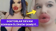 Ölümcül Olduğunu Bilmesine Rağmen Güzelleşmek Uğruna Dudaklarını Yaptırmaya Devam Eden İlginç Kadın