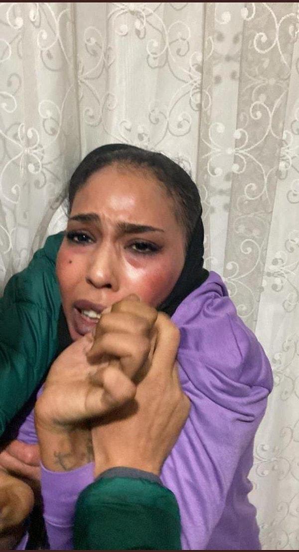 Saldırgan kadın daha sonra emniyet güçlerinin çabasıyla kaldığı evde kıskıvrak yakalandı.