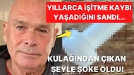 5 Yıl Boyunca İşitme Kaybı Yaşadığını Zanneden Adamın Kulağının İçinden Çıkan Şeye İnanamayacaksınız!