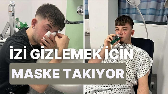 Deodorant Şişesinin Yüzüne Patlamasıyla Gözlerini Kaybetmekten Son Anda Kurtulan Adam