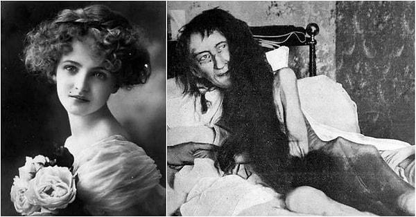 1. Güzelliğiyle bilinen Fransız kadın Blanche Monnier, annesinin onaylamadığı bir evlilik yapmak istediği için annesi tarafından 25 yıl boyunca çatı katındaki küçük karanlık bir odaya kilitlendi.