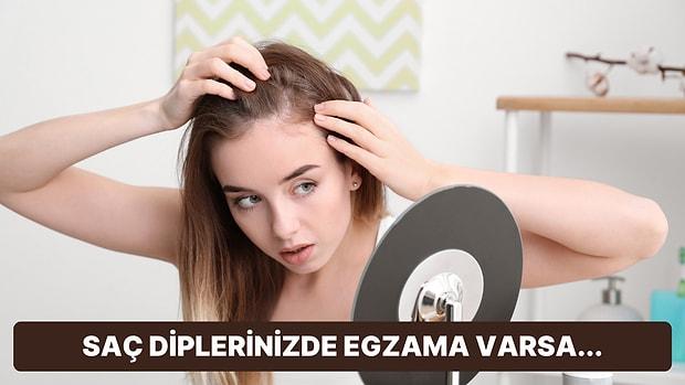 Saçlarınıza İyilik Yaparken Besleyen 11 Egzama Karşıtı Bakım Şampuanı Tavsiyesi