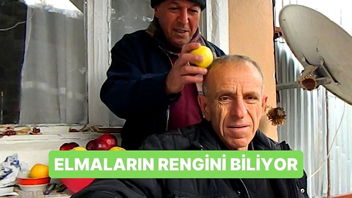 Herkesi Kıskandıran Yetenek: Kafasına Vurulan Elmanın Rengini Biliyor