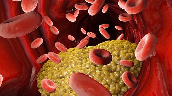 Araştırmacılar bal tüketiminin açlık kan şekeri seviyesinde ve kandaki, "kötü kolesterol" olarak da bilinen düşük yoğunluklu lipoprotein sayısında önemli oranda düşüşlere yardımcı olduğunu tespit etti.