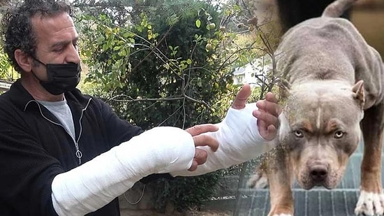 'Pitbull'lu Saldırıdan Köpeği Camdan Atarak Kurtuldu! Atardamarı Parçalandı