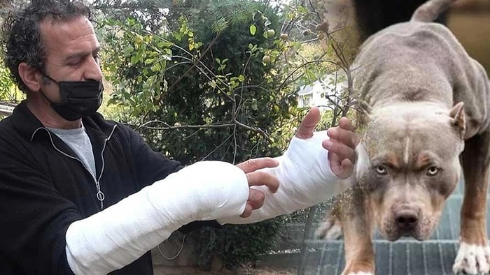 'Pitbull'lu Saldırıdan Köpeği Camdan Atarak Kurtuldu! Atardamarı Parçalandı