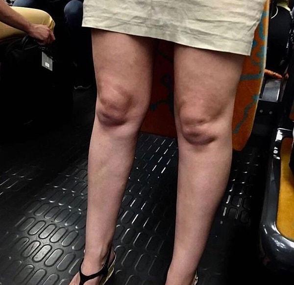 18. "Metroda dizlerine bebek sıkışmış bir kadın gördüm!" 😅