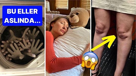 Baktığınız Anda Sebepsiz Yere Tüylerinizi Diken Diken Edip Tuhaflık Kotanızı Dolduracak 18 Görsel