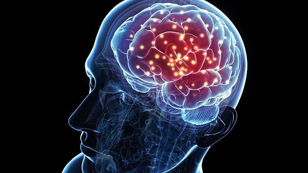 Yeni bir çalışmayla, bilim insanları, 7T MRI olarak bilinen, ultra yüksek çözünürlüklü MRI formu kullanarak migren hastalarının beyinlerine bakan ilk kişiler oldular.