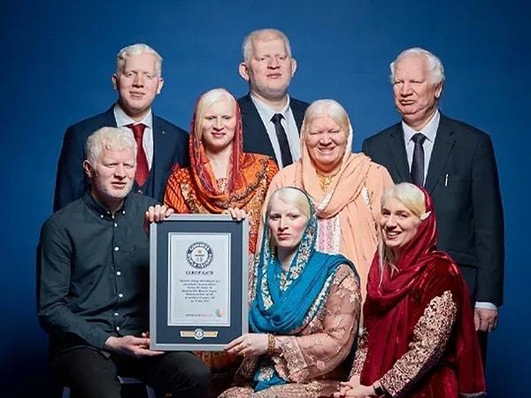 5. En çok Albino kardeş: İngiltere'de yaşayan Pakistan asıllı Parvez ailesi