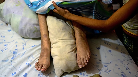 Канадцы пожертвовали 60 000 долларов человеку, подавшему заявку на эвтаназию, так как он больше не мог позволить себе жить