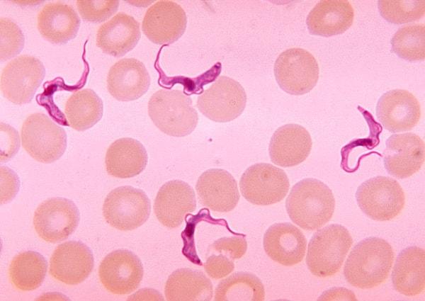 6. African trypanosomiasis