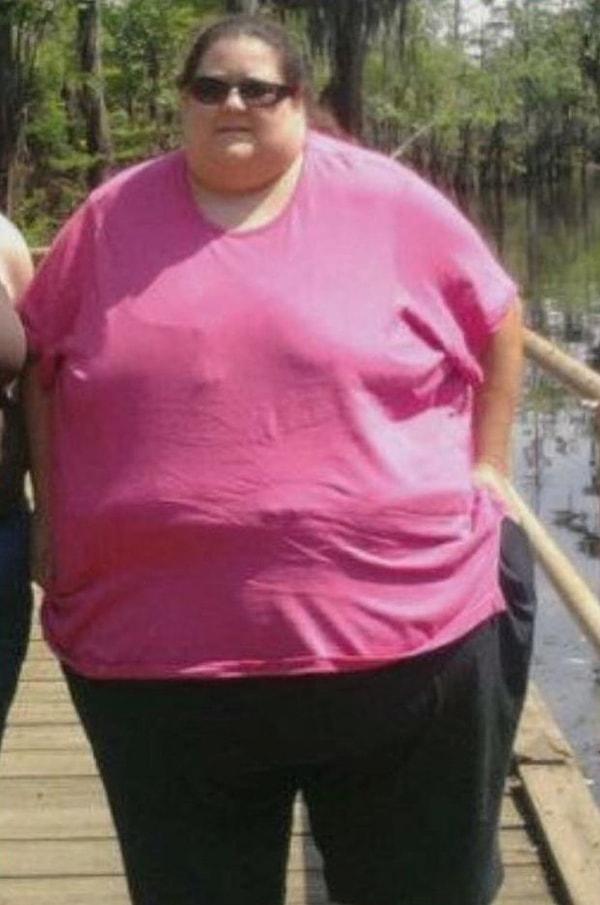 ABD'nin California eyaletinde yaşayan Teresa 272 kilo olduğu zaman hayatını değiştirmeye karar verdi ve inanılmaz bir değişim geçirdi.