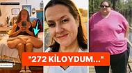Hayatını Kurtarmak İçin 167 Kilo Veren Kadının Ameliyattan Önceki Görüntülerine İnanamayacaksınız!