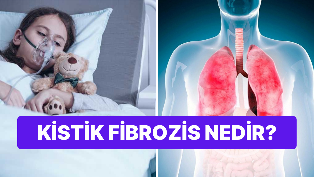 Fibrozis iyileşir mi?