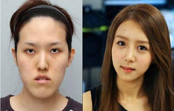 8. Güney Kore'de estetik yaptırmak özellikle gençler arasında çok yaygın, üstelik aileler için de bu çok normal bir durum!