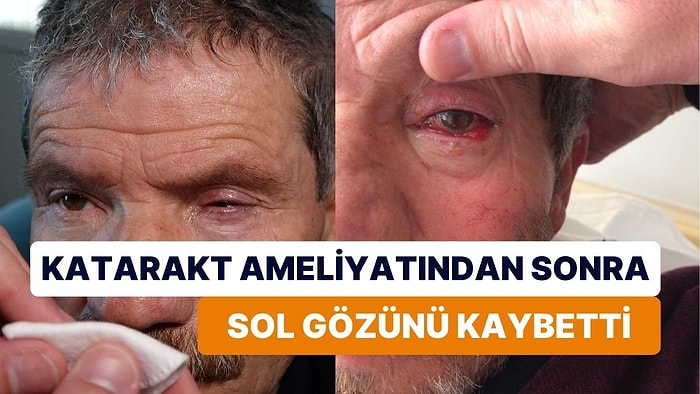 Katarakt Ameliyatından Sonra Sol Gözünü Kaybetti: Soruşturma Başlatıldı