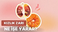 Ülkemizin En Büyük Tabusu Olan Kızlık Zarı Nedir? Gerçekte Ne İşe Yarar?