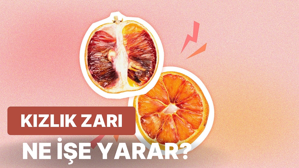 Ülkemizin En Büyük Tabusu Olan Kızlık Zarı Nedir? Gerçekte Ne İşe Yarar?
