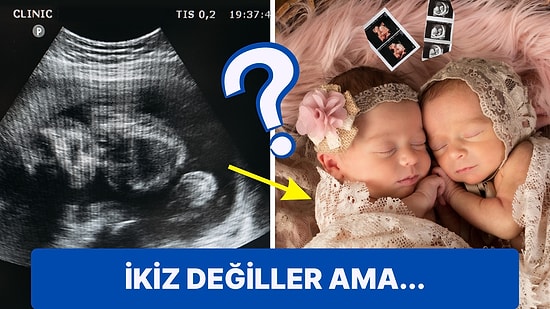 Hamileyken Tekrar Hamile Kalma Durumu Olan Süperfetasyon Nasıl Gerçekleşir?