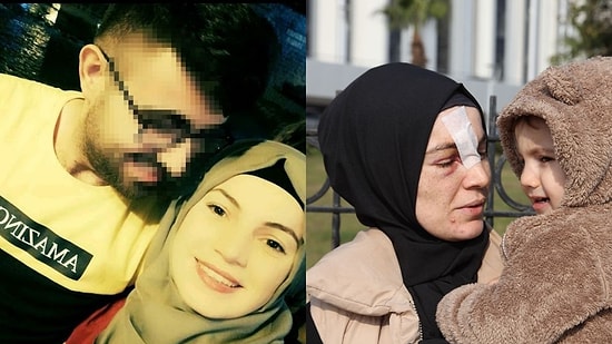 Cinsel İlişki Teklifini Reddettiği Kocası Tarafından Dövüldü: "Senin Başka Görevin mi Var?"