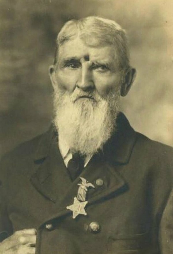 10. Джейкоб Миллер (1829-1917), получил пулю в голову в Чикамауге в 1863 году, но выжил