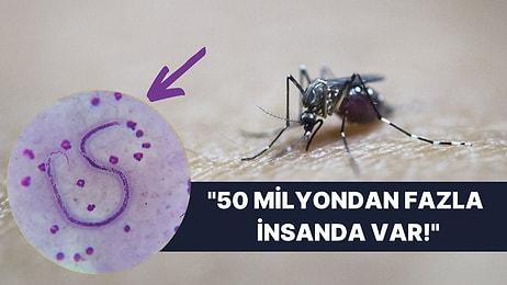 Sivrisinek Isırdığı İçin Testislerinde Solucan Çıkan Adamın Midenizin Ayarlarıyla Oynayacak Görüntüleri