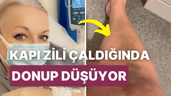 Heykele Dönüşerek Yere Düşmeye Neden Olan Bir Hastalıktan Muzdarip Kadın Yaşadıklarını Anlattı