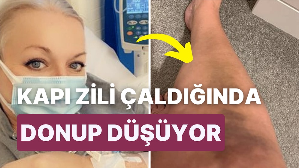 Heykele Dönüşerek Yere Düşmeye Neden Olan Bir Hastalıktan Muzdarip Kadın Yaşadıklarını Anlattı