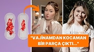 Adet Olurken Epey Nadir Görülen Tuhaf Bir Durumla Karşılaşan Kadının Yaşadıklarına İnanamayacaksınız!