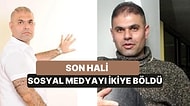 Çikita Muz Şarkısıyla Ünlenen Popstar Ajdar Son Hali ile Gündemde