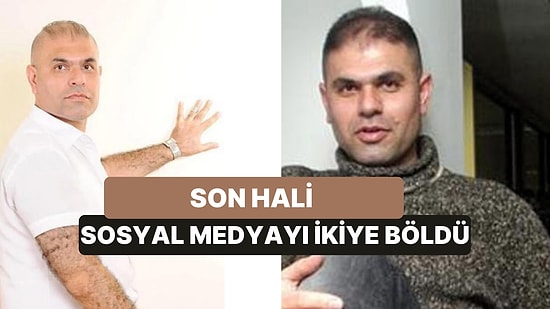 Çikita Muz Şarkısıyla Ünlenen Popstar Ajdar Son Hali ile Gündemde