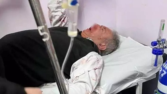 Bağcılar'da Aile Hekimine Saldırı