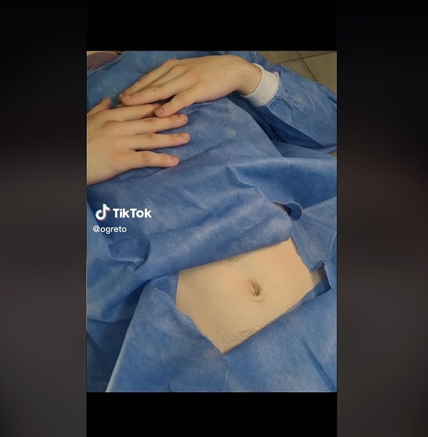 Arjantinli TikToker Ezequiel, ameliyatla göbek deliğini aldırdığını söylediği bir video paylaştı.