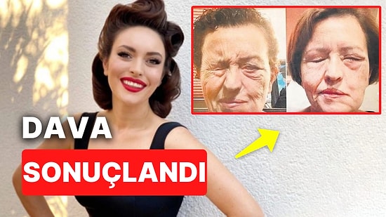 Ezgi Mola'nın Annesi Jale Erkan İçin Dava Sonuçlandı: Çıkan Karar Ağızları Açık Bıraktı!