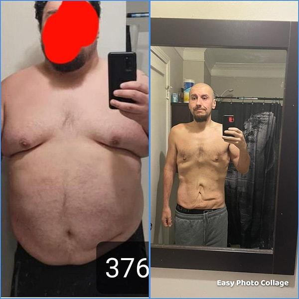 15. "15 ayda 90 kilo verdim. Safra kesesi ameliyatı oldum ve iyileşip spora geri dönmek için sabırsızlanıyorum."
