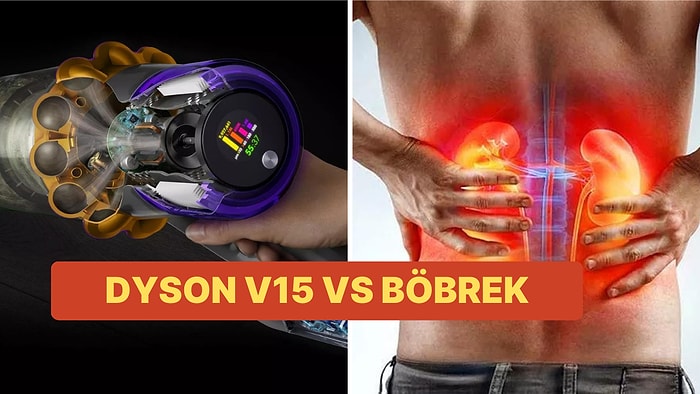 Dyson V15 Detect Absolute İçin Böbrek Satmaya Değer mi?