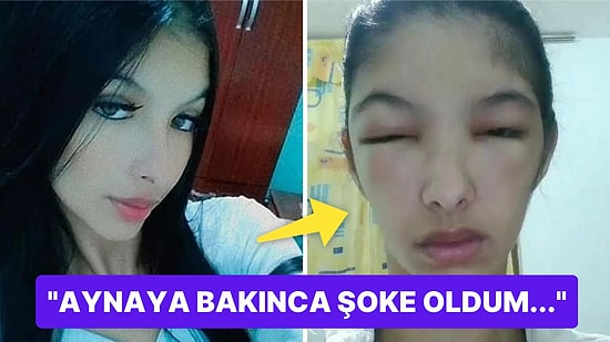 Saçını Boyadıktan Sonra Hayatı Kararan Bahtsız Kadının Yaşadıklarına İnanamayacaksınız!