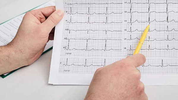 EKG Nedir?