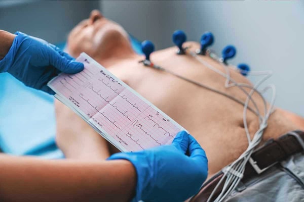 EKG Çeşitleri Nelerdir?