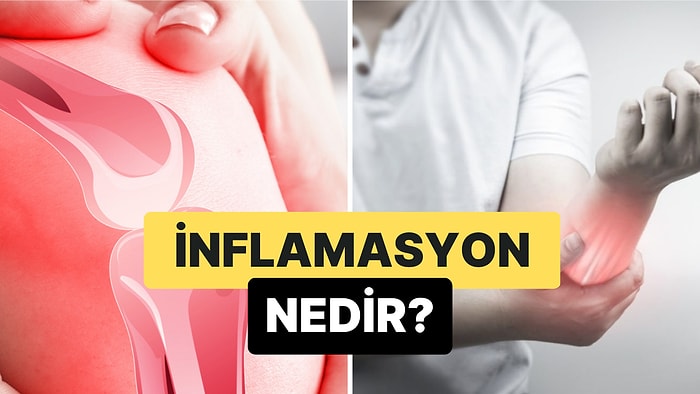 Bağışıklık Sisteminin Oluşturduğu Doğal Bir Tepki: İnflamasyon Nedir?