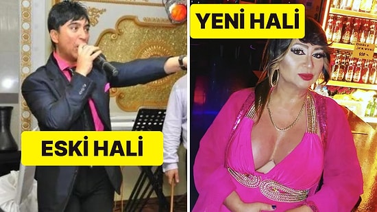 Cinsiyet Geçiş Operasyonundan Sonra Adını Eylem Erener Yapan Sanatçıyı Tanıyor muydunuz?