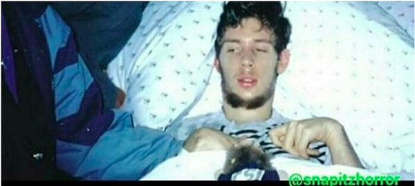 16. Мужчина очнулся из комы после 2-х лет, но не был способен подать признаки этого. Он был вынужден находится в полуживом состоянии на протяжении почти 10 лет, хотя четко осознавал, что происходит вокруг все это время.